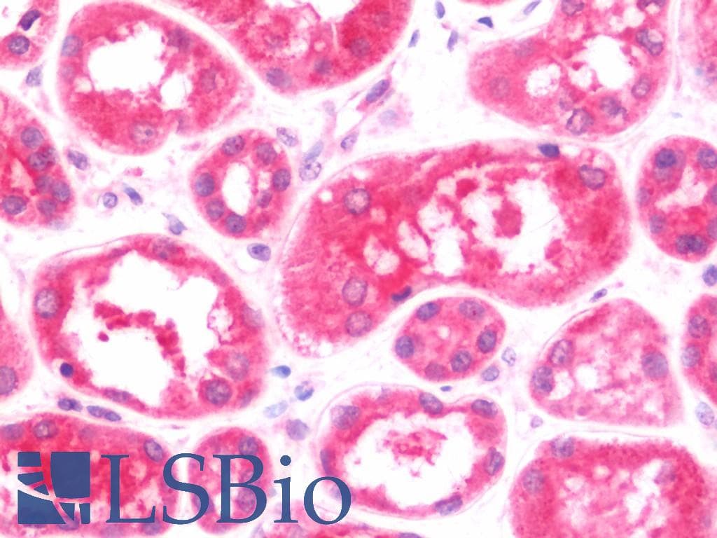 IHC-plus™ MTBP / Mdm2-Binding Protein Antibody