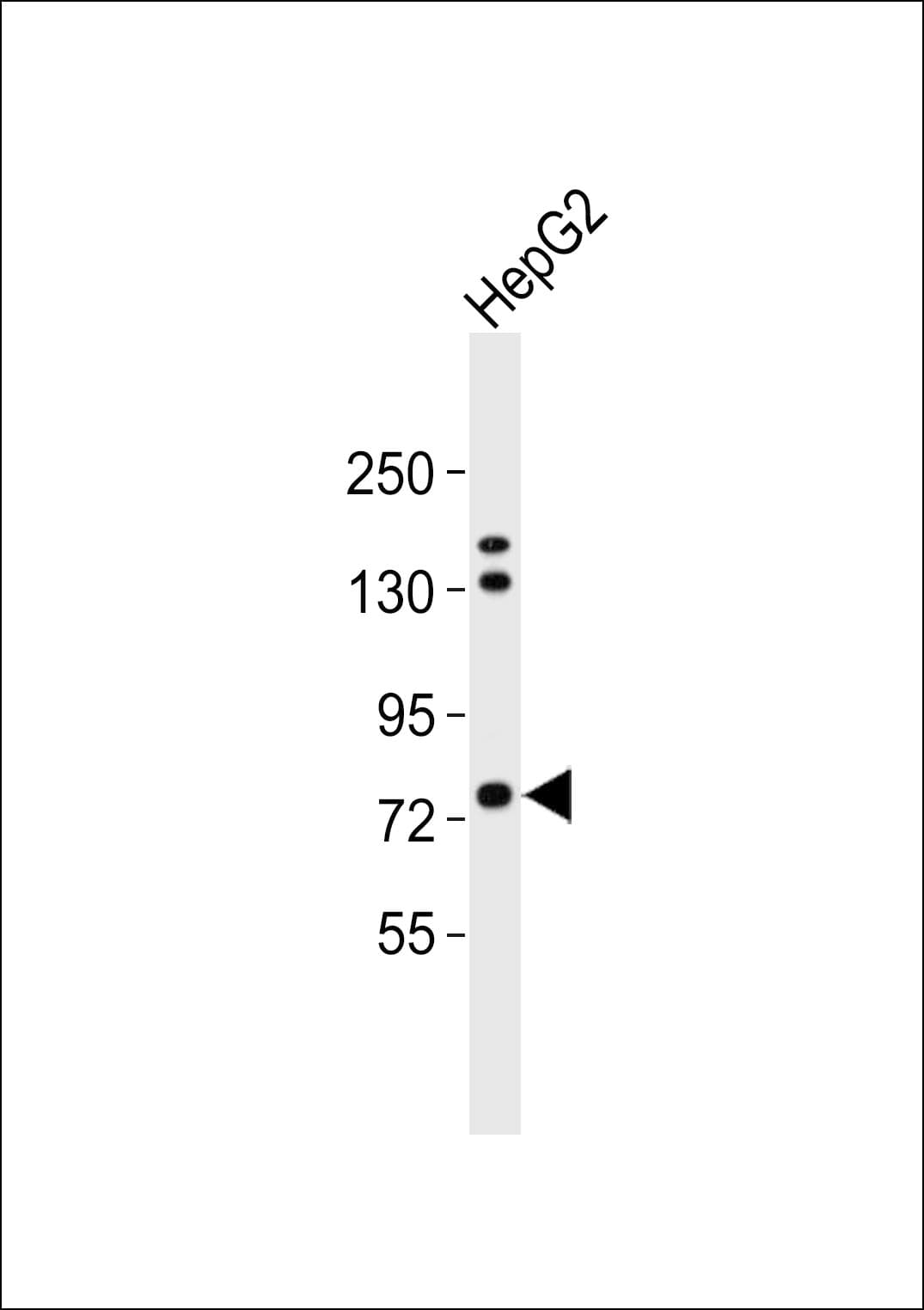 FSH Receptor / FSHR Antibody