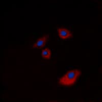 IHC-plus™ KRT20 / CK20 / Cytokeratin 20 Antibody (C-Terminus)