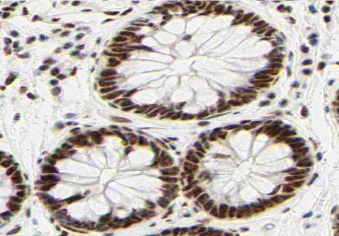 HDAC1 Antibody