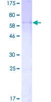 Human PPP1R3C / PTG Protein (Recombinant GST)