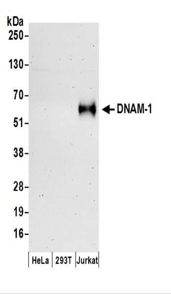 IHC-plus™ DNAM-1 / CD226 Antibody (aa286-336)