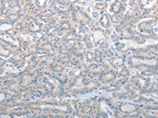 Polyclonal Rabbit anti-Human SLC17A6 / VGLUT2 Antibody (IHC)