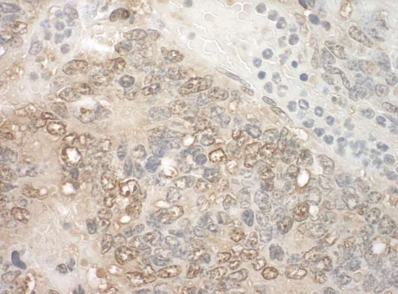 KIAA0191 / ZCCHC11 Antibody (aa250-300)