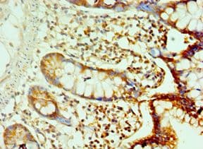 Polyclonal Rabbit anti-Human CDH17 / Cadherin 17 Antibody (aa573-832, IHC)