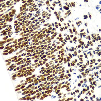 Polyclonal Rabbit anti-Human Histone H3 Antibody (IHC, IF, WB)