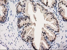 GALE / UDP-Glucose 4-Epimerase Antibody (clone OTI1C4)