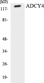 ADCY4 / Adenylate Cyclase 4 Antibody (aa177-226)