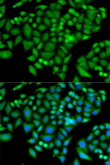 CHAF1B / CAF1 Antibody