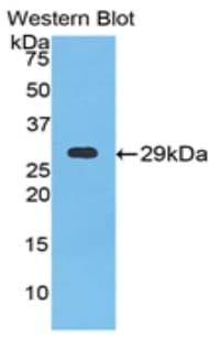 NPTX1 Antibody (aa146-384, Cy3)