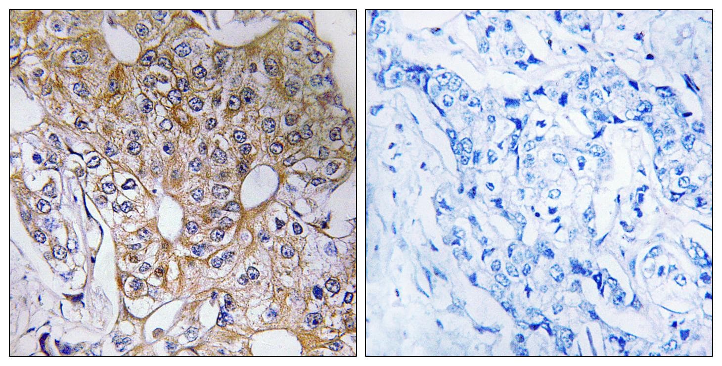 CCT6A Antibody