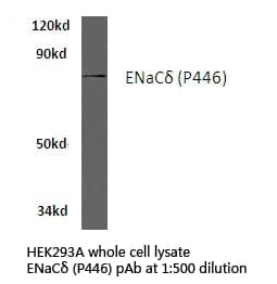 SCNN1D Antibody (Pro446)