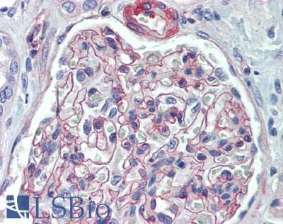 IHC-plus™ LAMB2 / Laminin Beta 2 Antibody (aa1579-1798)