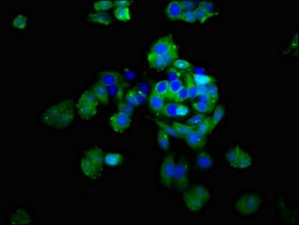 DSG2 / Desmoglein 2 Antibody