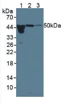 ORM1 / Orosomucoid Antibody (APC)