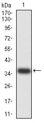 PAK3 Antibody (clone 4G8A5)