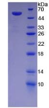 Human DSG1 / Desmoglein 1 Protein (Recombinant His,N-terminus)