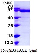 Human RNMT / HCM Protein (Recombinant His)