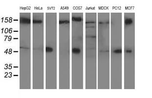 AP50 / AP2M1 Antibody (aa97-383, clone OTI1E9)