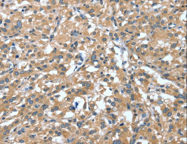 DTX1 / Deltex Antibody