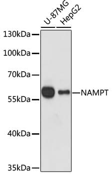 Polyclonal Rabbit anti-Human NAMPT / Visfatin Antibody (IHC, IF, WB)