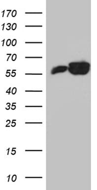 Monoclonal Mouse anti-Human PTBP3 / ROD1 Antibody (clone OTI5G7, aa300-552, IHC, WB)
