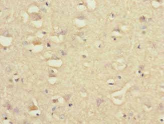 GRIK3 / GLUR7 Antibody
