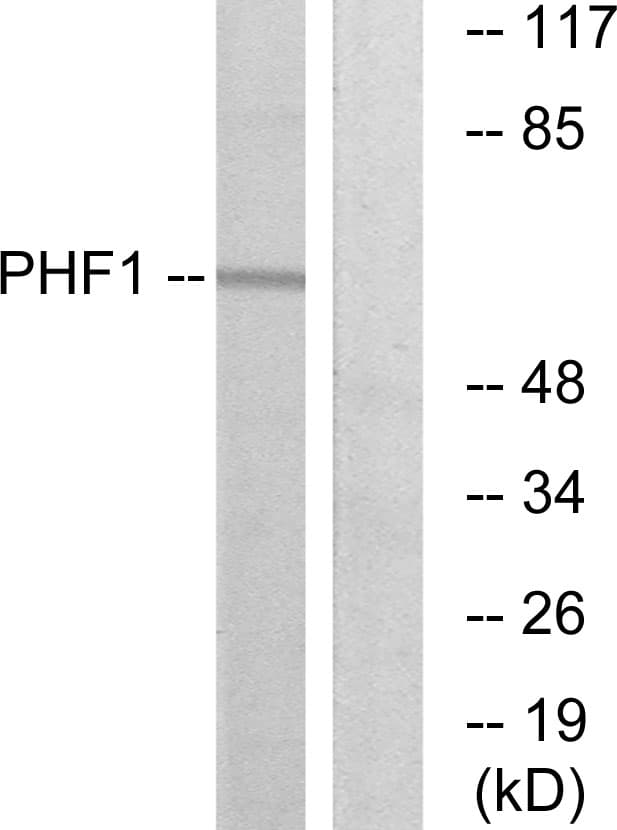 Polyclonal Rabbit anti-Human PHF1 Antibody (aa345-394, WB)