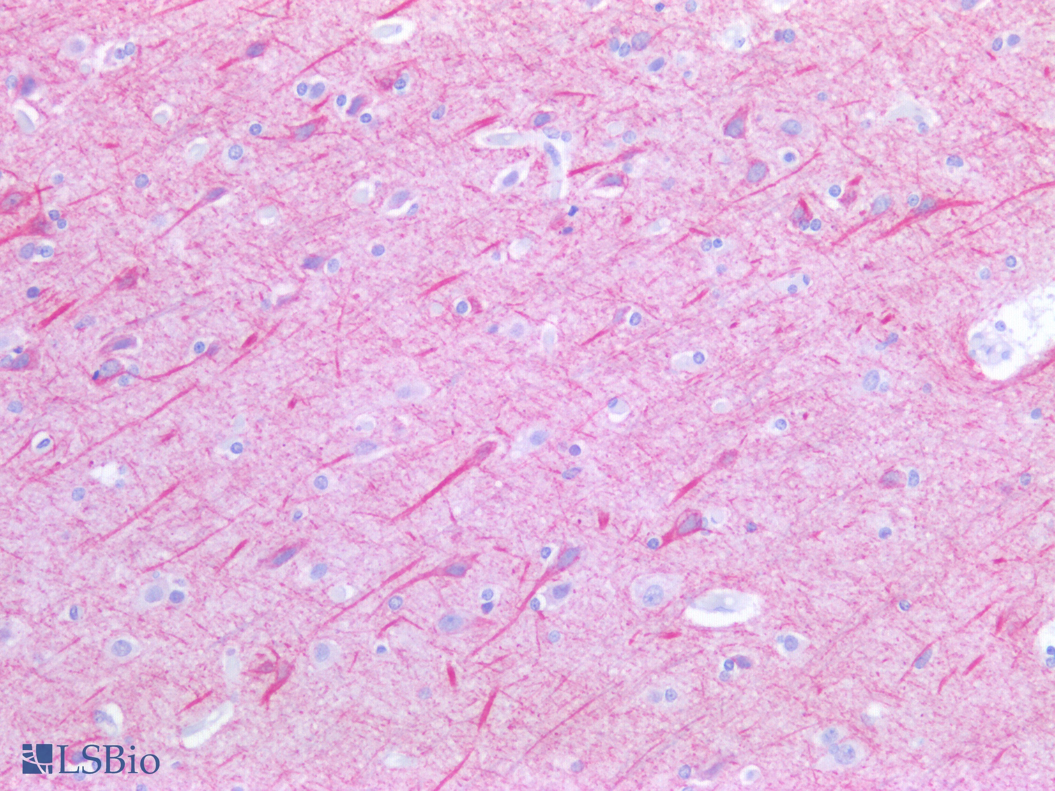 IHC-plus™ NF-L / NEFL Antibody (C-Terminus)