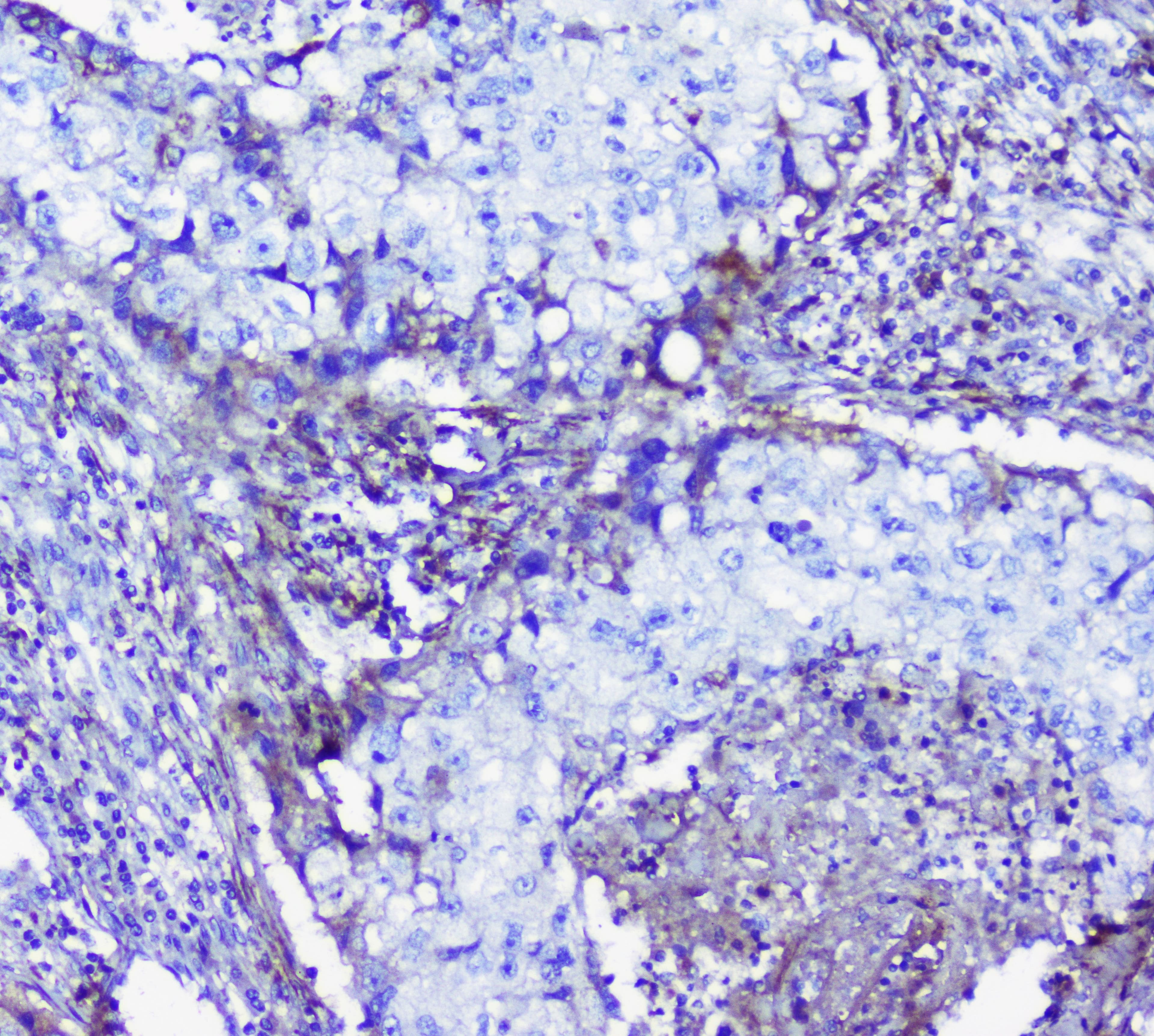 Polyclonal Rabbit anti-Human Lumican Antibody (IHC, WB)