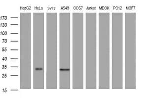 ING2 Antibody (clone OTI1E12)