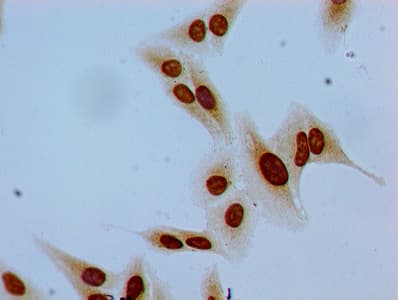 HIST1H1E Antibody (phospho-Ser35)