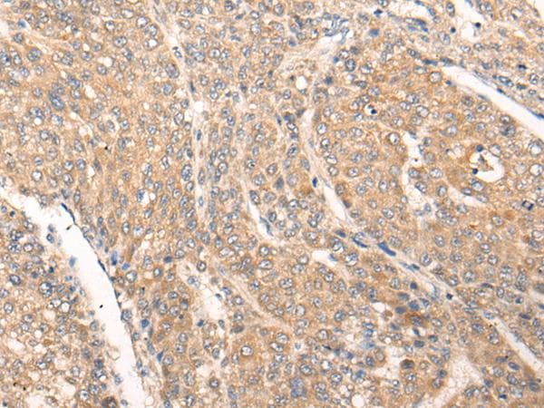 Polyclonal Rabbit anti-Human PIAS3 Antibody (IHC)