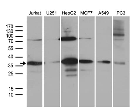 PPP4C Antibody (clone OTI2E4)