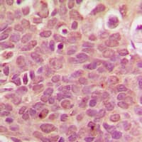 RPL36 / Ribosomal Protein L36 Antibody (Internal)