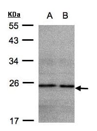 NDUFB9 Antibody (aa1-162)