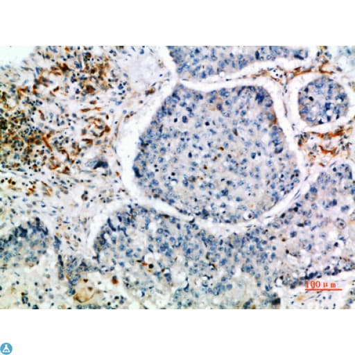 CISH / SOCS Antibody