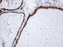 PAI-RBP1 / SERBP1 Antibody (clone OTI5G2)