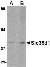 IHC-plus™ SLC35D1 Antibody