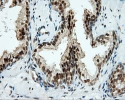 TUBA8 / Tubulin Alpha 8 Antibody (clone OTI2E9)