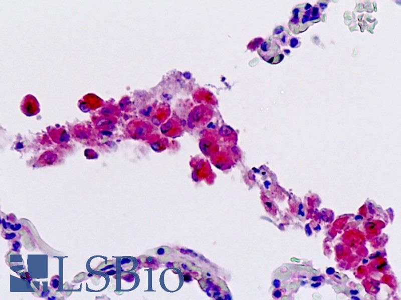 IHC-plus™ FFAR2 / GPR43 Antibody (aa286-315)