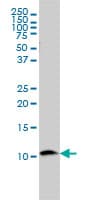 IHC-plus™ Monoclonal Mouse anti-Human B2M / Beta 2 Microglobulin Antibody (clone 3F9-2C2, IHC, IF, WB)