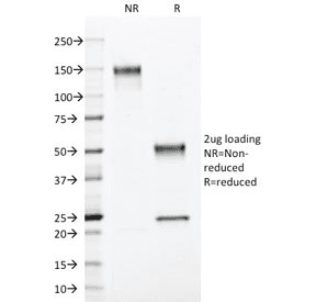 Monoclonal Mouse anti-Human PR / Progesterone Receptor Antibody (clone PGR/2694, Ready-to-Use, IHC)