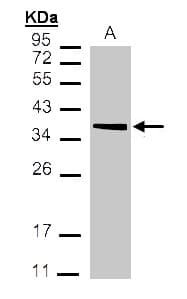 IHC-plus™ Polyclonal Rabbit anti-Human MDH / MDH2 Antibody (aa40-319, IHC, WB)