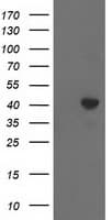 ACAT2 Antibody (clone OTI7B1)
