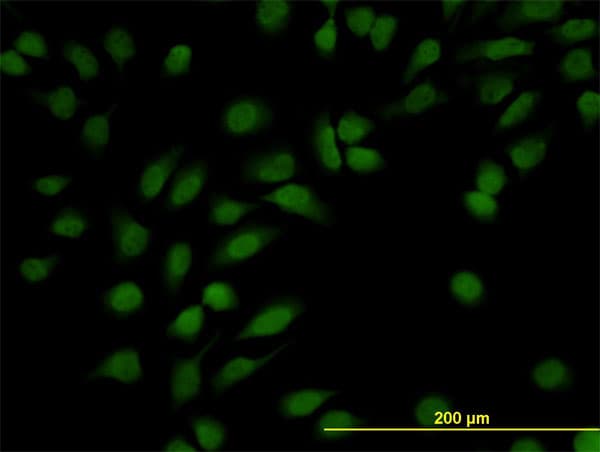 NR3C1/Glucocorticoid Receptor Antibody (clone 2C8)