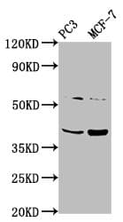 PCGF6 Antibody