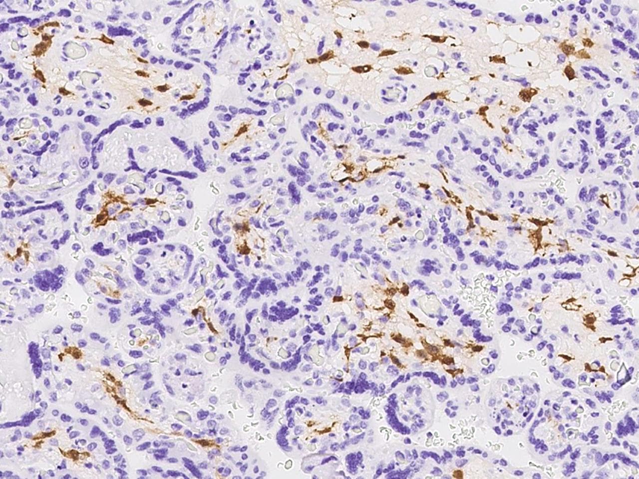 F13A1 / Factor XIIIa Antibody