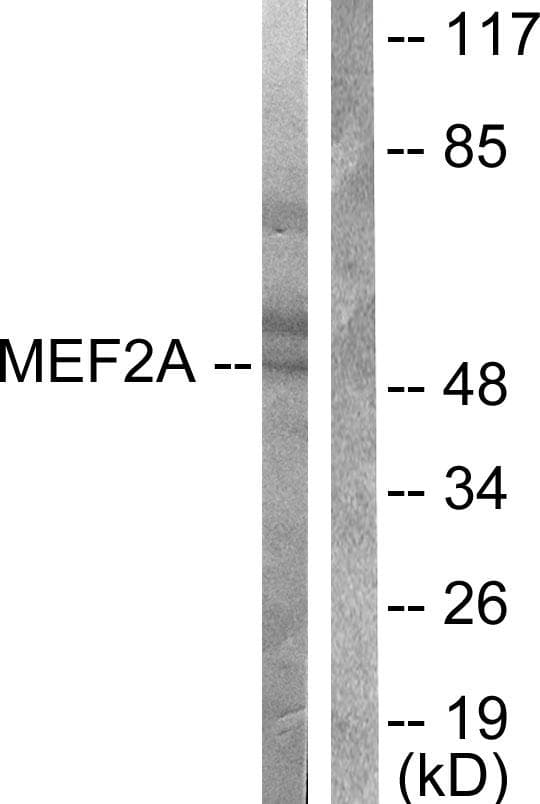 Polyclonal Rabbit anti-Human MEF2A / MEF2 Antibody (p408, IHC, IF, WB)