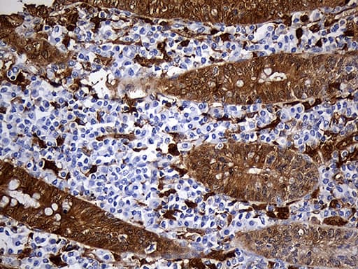 M-PST / STM Antibody (clone OTI6A8)